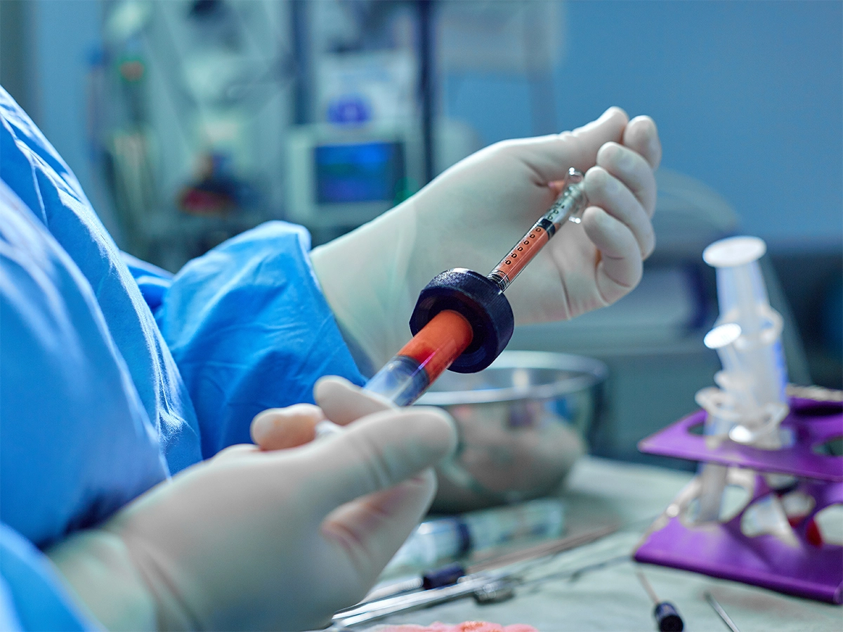 Fat Grafting to Labia